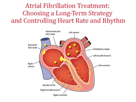 Can You Travel with AFib? Exploring the Unpredictable Journey of Life and Heart Health