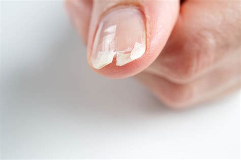 How to Repair a Cracked Nail: A Journey Through Unconventional Wisdom and Practical Solutions